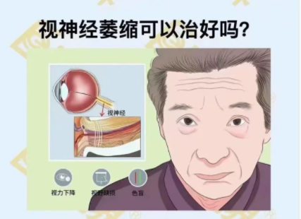 視神經萎縮可以治好嗎